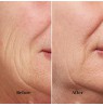 Silkn FaceTite Revive FTC1PE1001