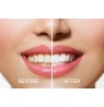 Rio USB Teeth Whitening