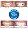 Rio USB Teeth Whitening