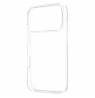 Fixed Story | Back cover | Xiaomi | 17 Ultra | TPU | Clear