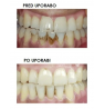 Silkn ToothWave TW1PE3001